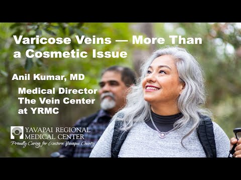 Varicose Veins — More Than a Cosmetic Issue with Anil Kumar, MD